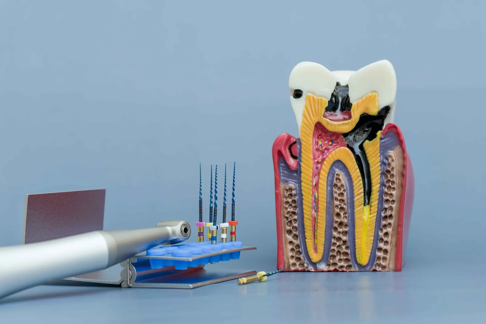 Tooth model showing the root canal system with endodontic instruments