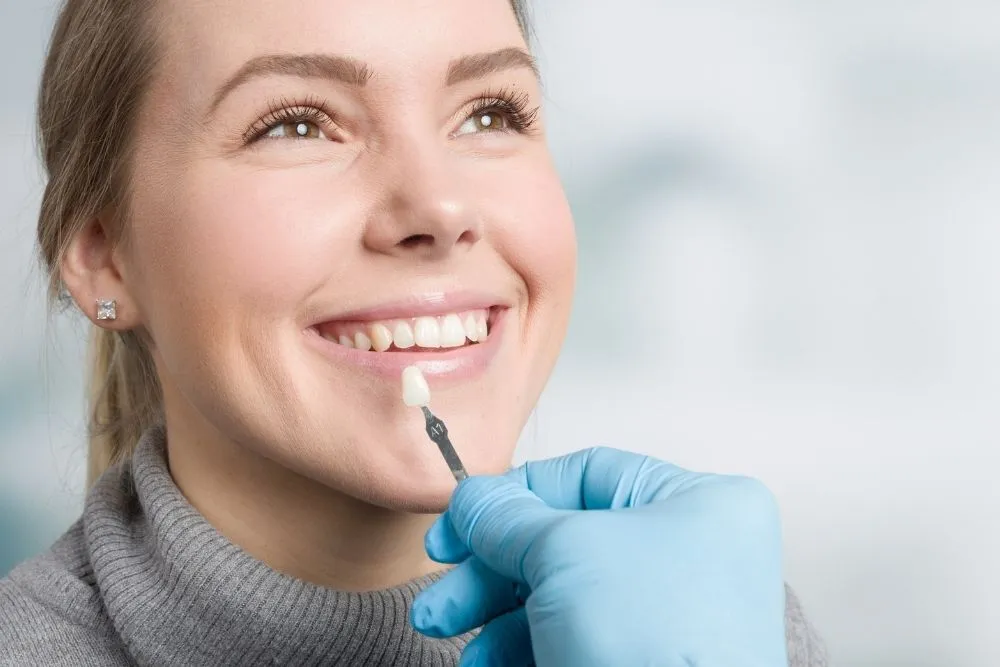 Dental shade matching for porcelain or composite veneers in Hornchurch