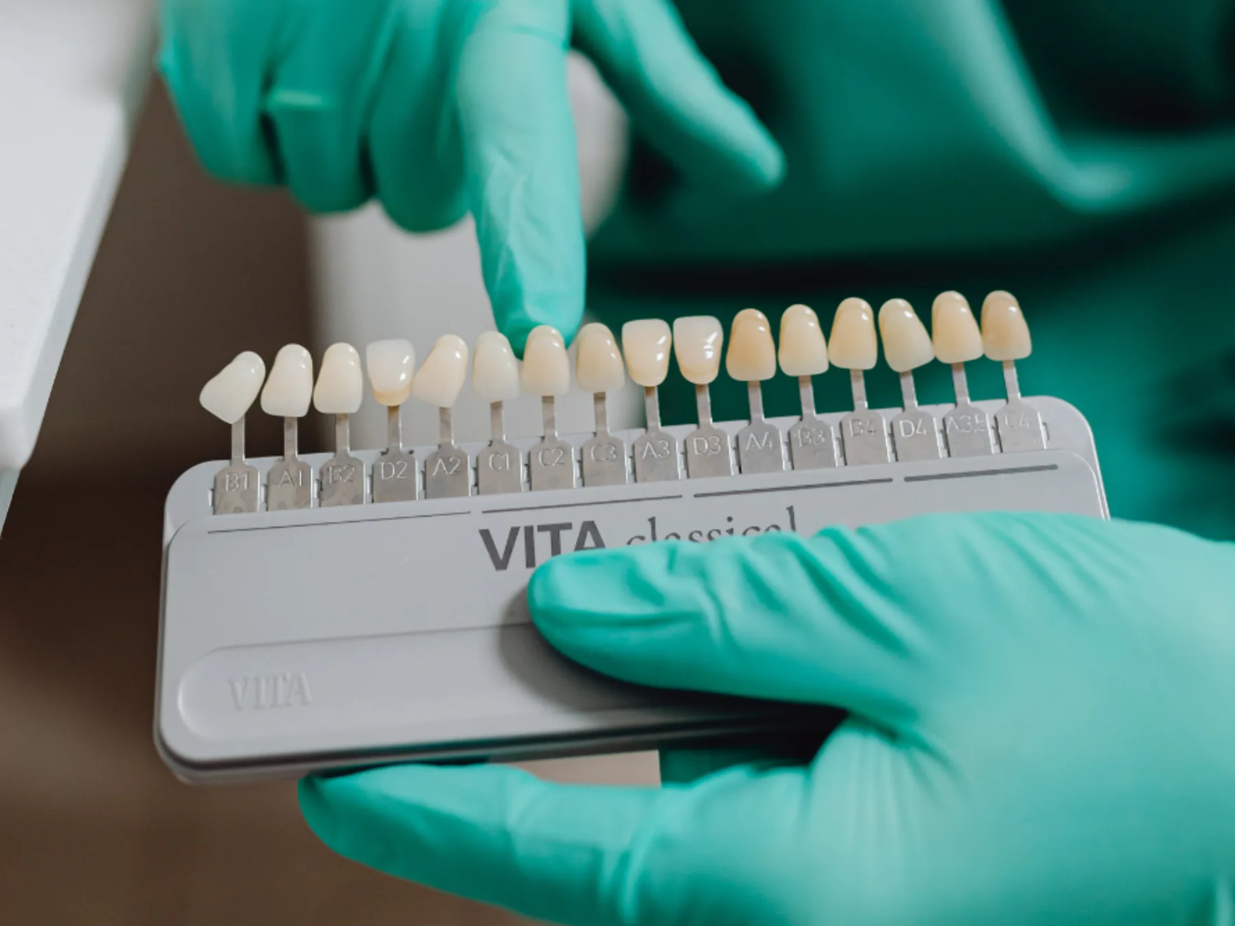 Dental shade guide held against composite samples for matching the bonding colour to natural teeth